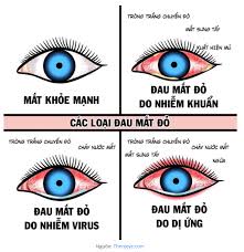 DAU MAT DO1
